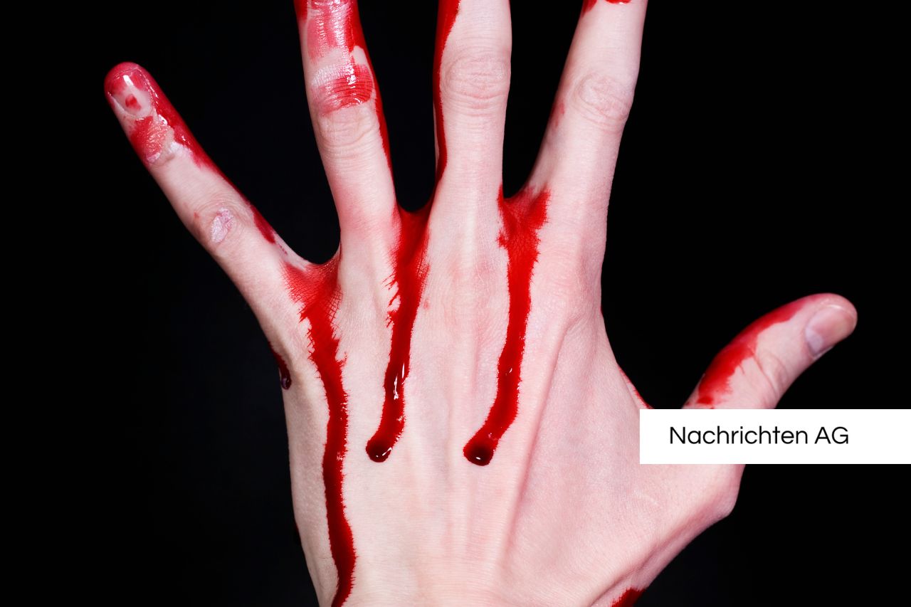 Neues Netzwerk für Lipodystrophie: Experten bündeln Kräfte in Deutschland